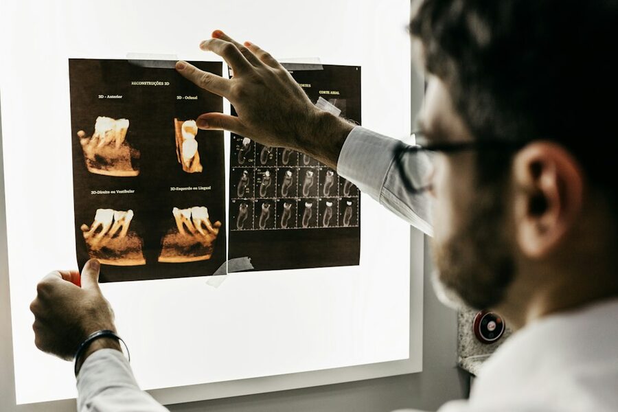 Endodonție